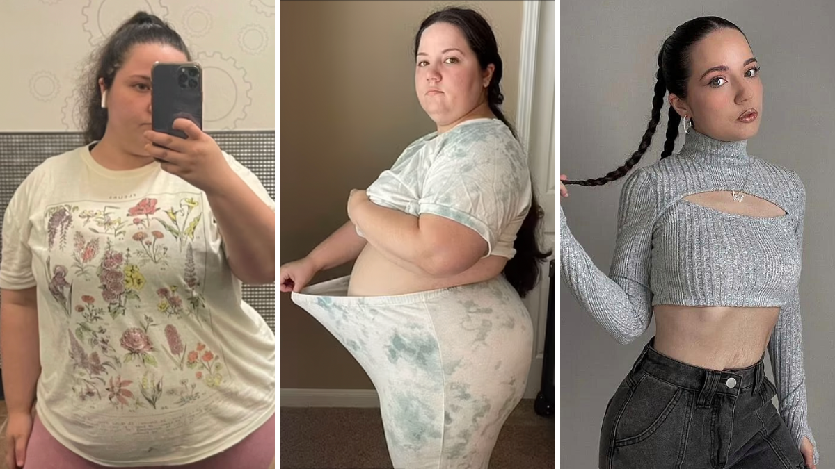 Reclaiming the scale, reclaiming her future: How surgical weight