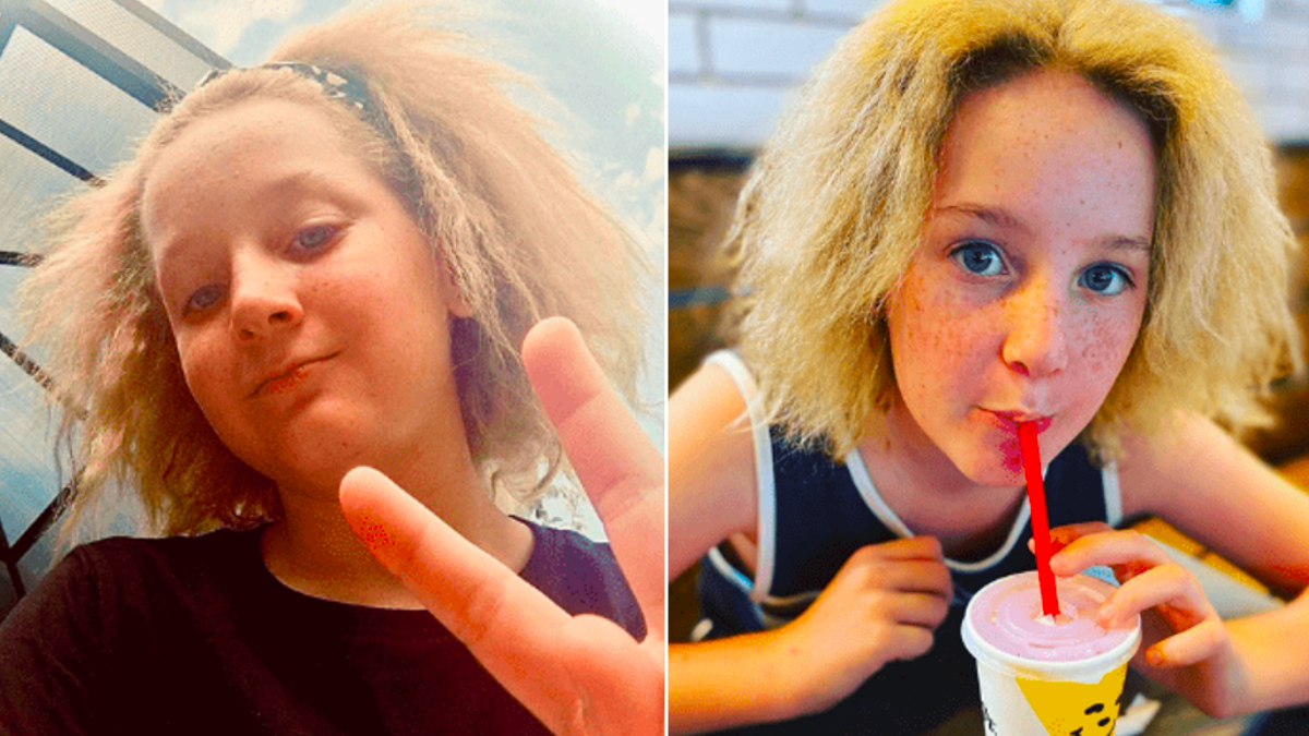 12 Year Old Girl Fully Embraces Her Genetic Uncombable Hair Syndrome 9472